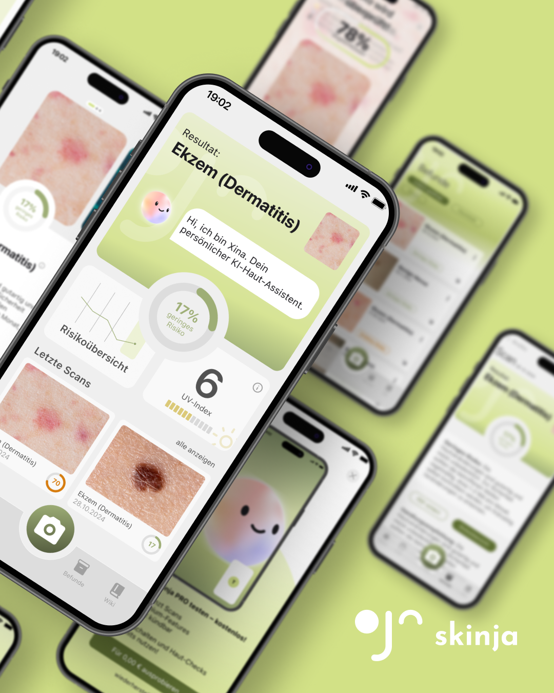 skinja_KI_Hautanalyse